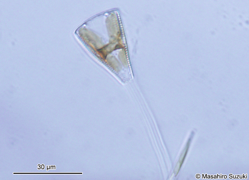 クサビケイソウ Gomphonema